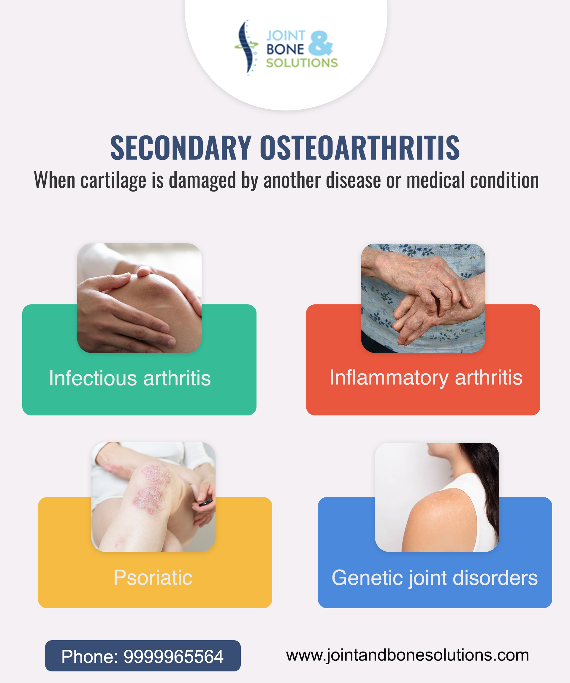 Osteoarthritis