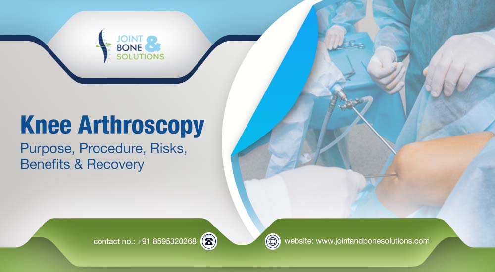 Knee Arthroscopy Surgery in Gurgaon